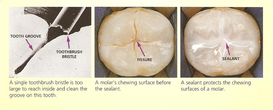 sealant graphics